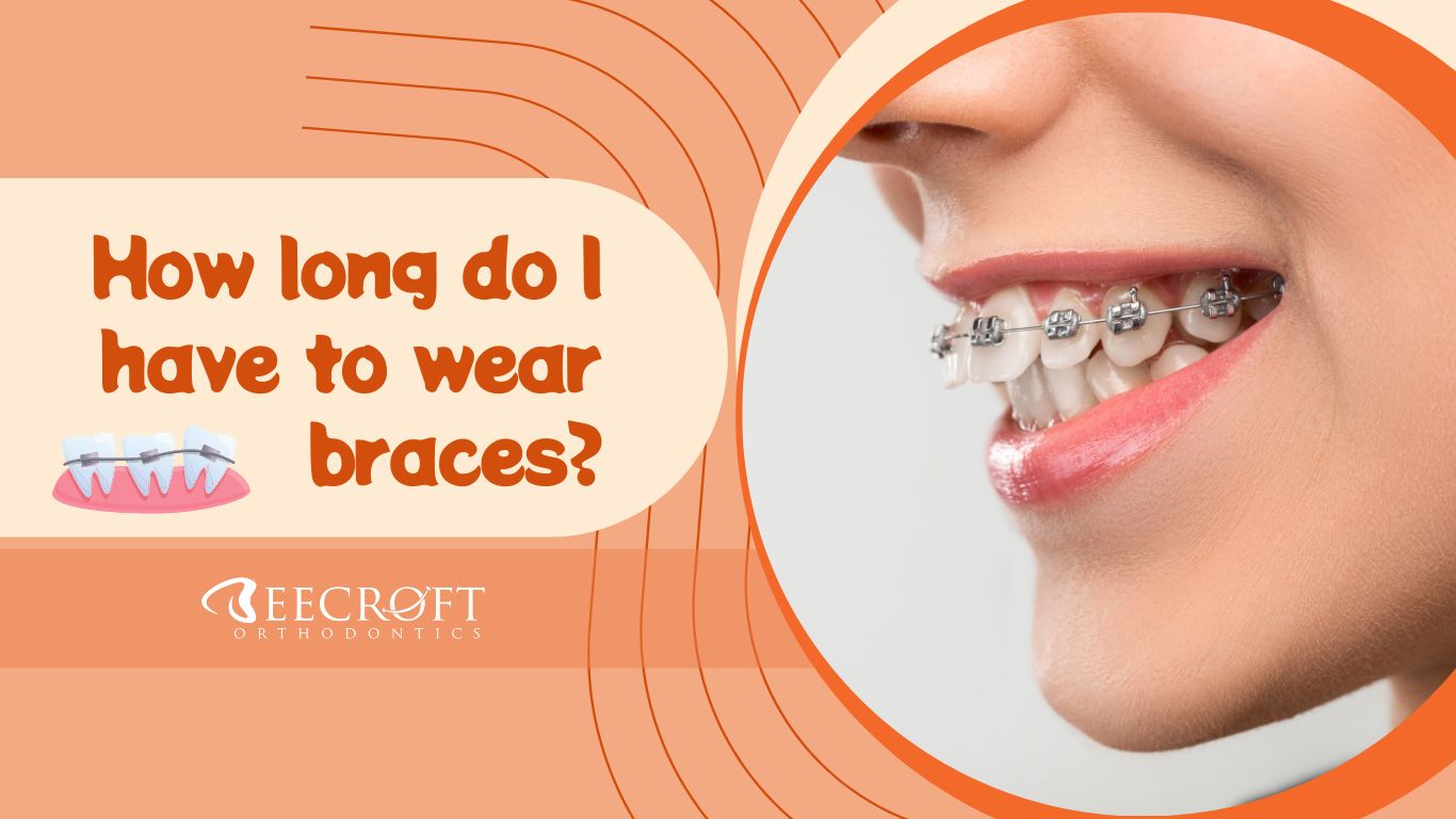 Braces In A Day Same Day Braces In Plantation Florida