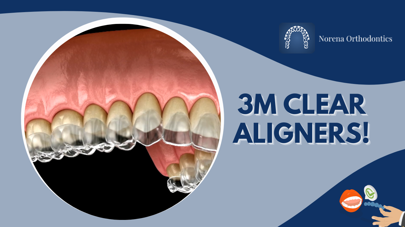 3M CLEAR ALIGNERS